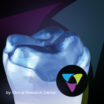 an image of a good occlusal onlay prep made with Komet burs