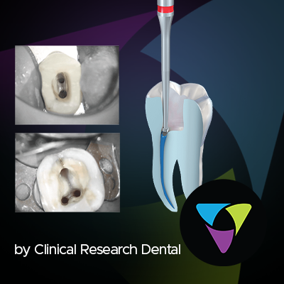 banner featuring endodontic burs