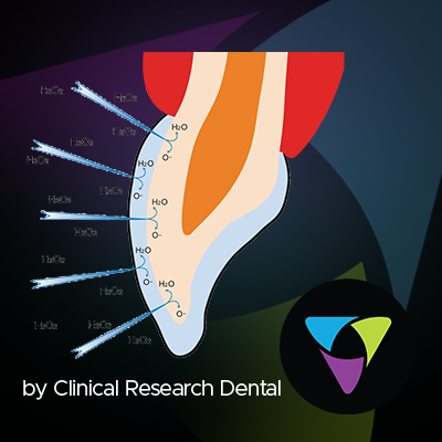 FAQ sur le blanchiment des dents 