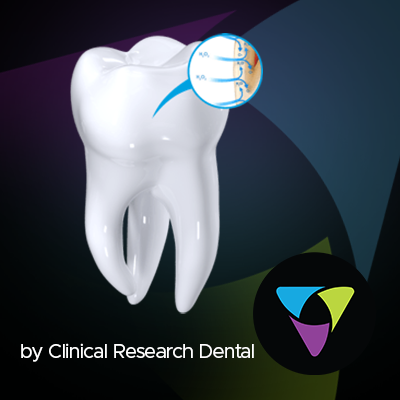 see the difference between chemical teeth whitening and UV light teeth whitening