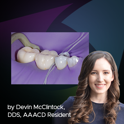 posterior teeth isolated by purple rubber dam