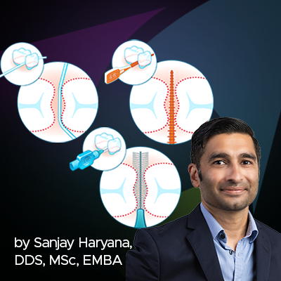 Interdental Cleaning on a Scientific Foundation