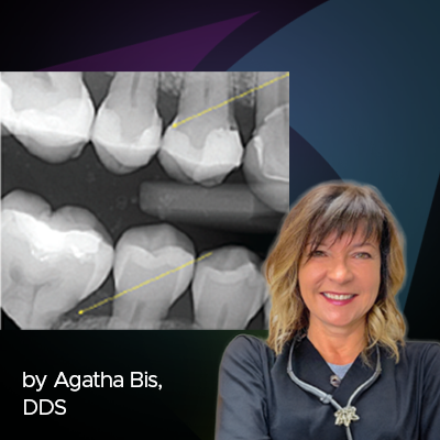 article thumbnail featuring Dr Agatha Bis and a dental x-ray