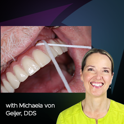 Soins des implants : entretien avec le Dr Michaela von Geijer, DDS 