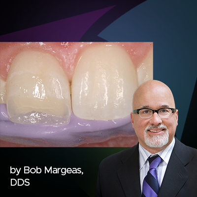 Demandez à l'expert : une entrevue avec Bob Margeas, DDS sur les composites universels 