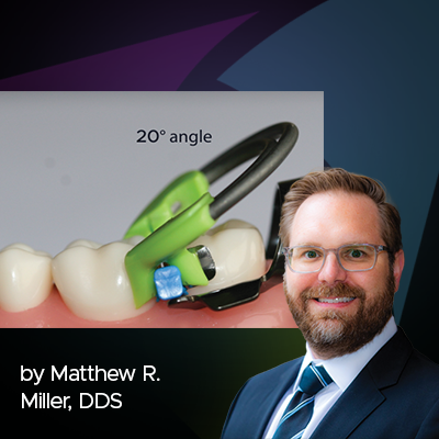 Ask the Expert: An Interview with Matthew R. Miller, DDS on Sectional Matrix Systems