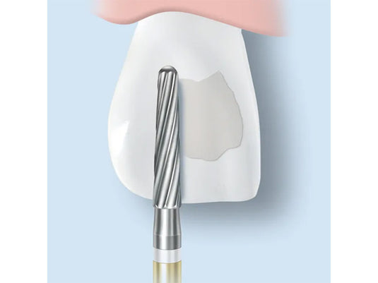 H22ALGK removes adhesive on a labial surface of a tooth