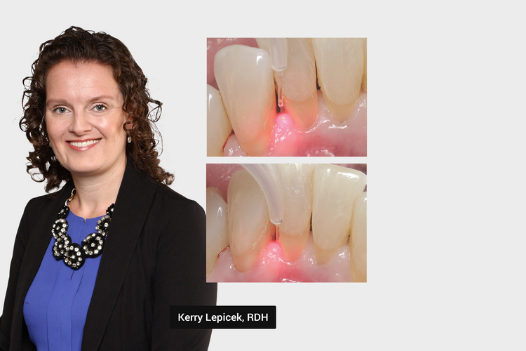 integrating laser technology into your preventive care strategies by kerry 