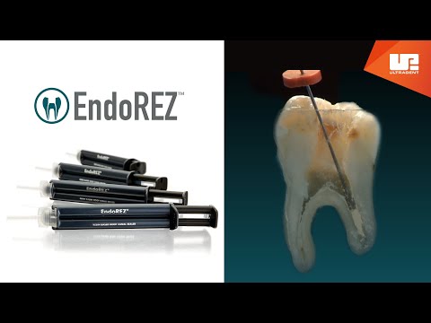 how to use EndoRez root canal sealer