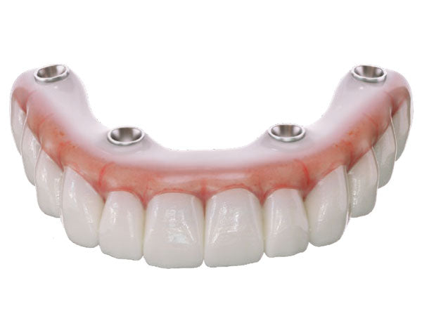 Load image into Gallery viewer, real dentures made with OnX Tough 2
